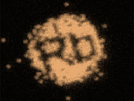 Quantum gas microscopes